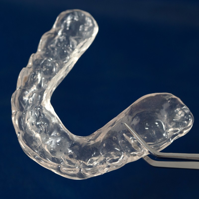 Night Guards in Woodbridge | YKim Dental