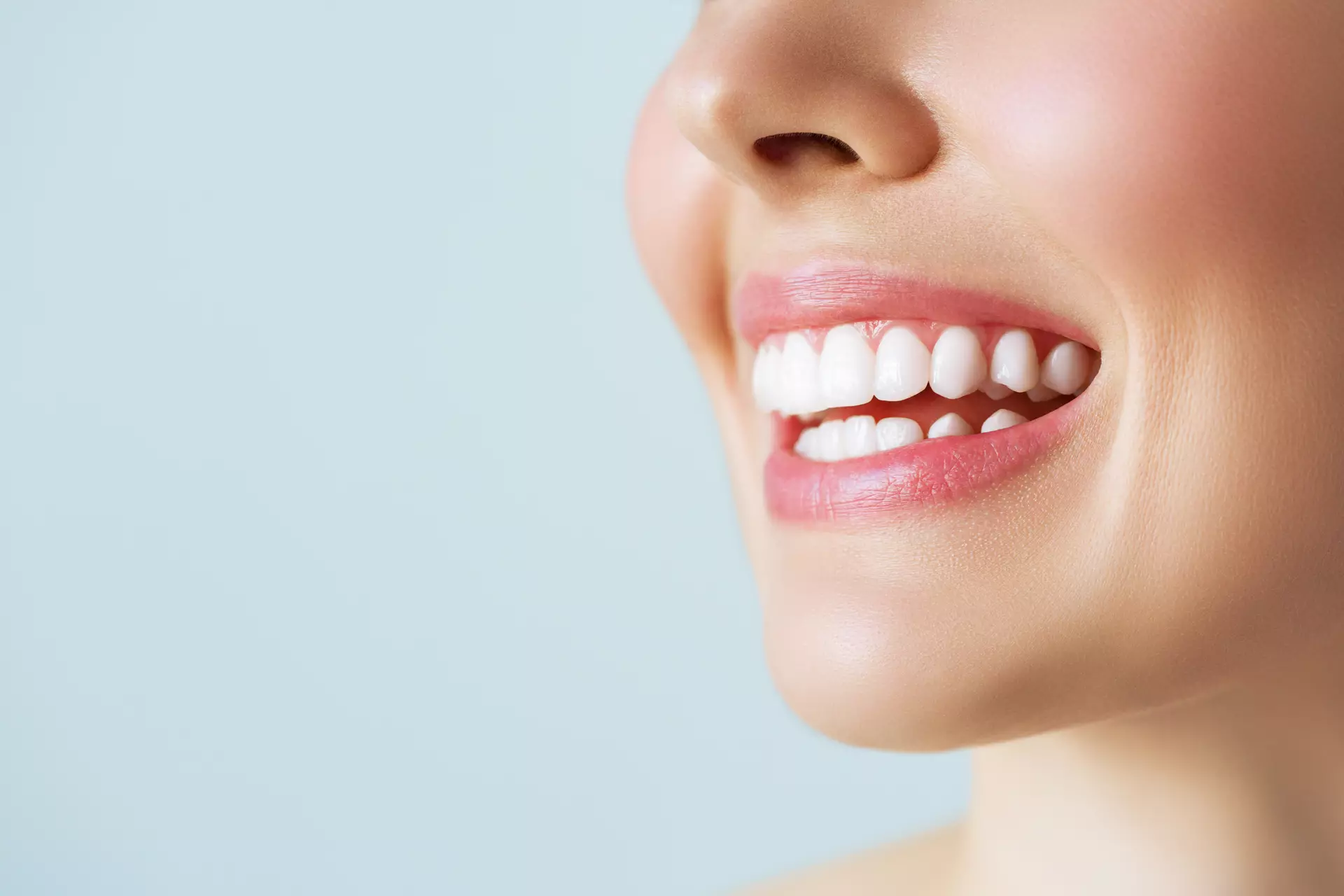 In-House Crowns